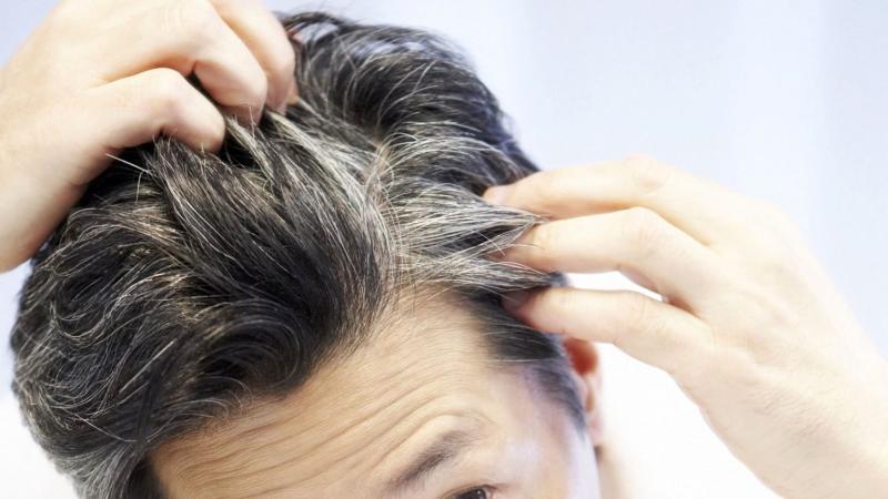 Ученые: Поседевшие волосы могут вновь обрести свой первоначальный цвет