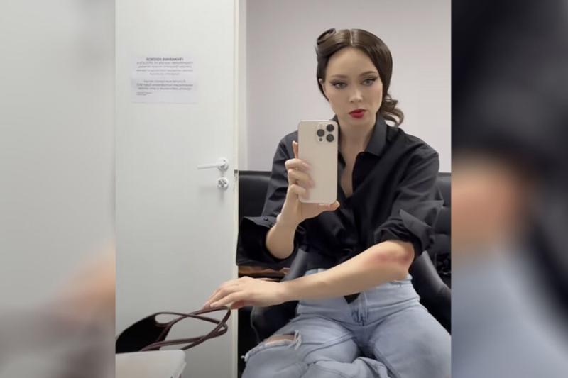 Актриса Настасья Самбурская показала ссадину на руке от Стаса Костюшкина