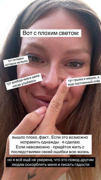 Певица Рита Дакота заявила, что сделала неудачную пластику
