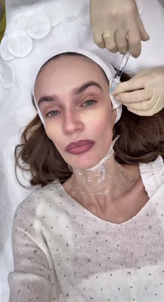 Блогерша Алена Водонаева сделала инъекцию с ДНК лосося