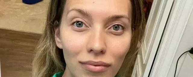 Телеведущая Тодоренко пожаловалась на морщины из-за плотного графика