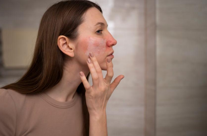 Доцент Ирина Волгина перечислила причины сухости кожи